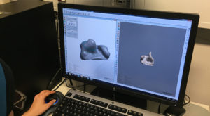 医疗3D打印